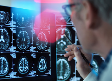 Florida Today Runs Bailey Op-Ed about the Necessity of Nonhuman Primates in Alzheimer’s Research